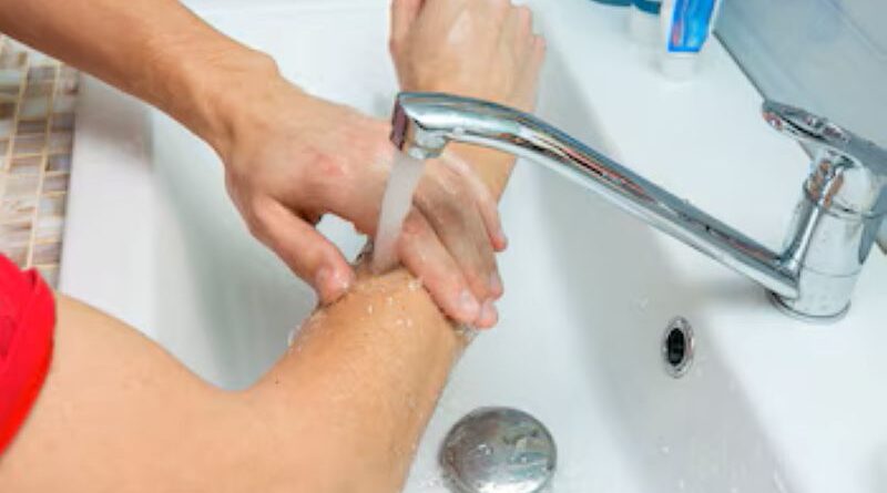 Prevención de Quemaduras en el Hospital Dr. Marcial Quiroga de San Juan